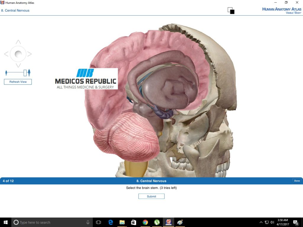 visible body human anatomy atlas free download