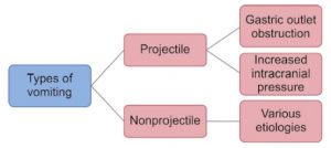 Projectile And Non Projectile Vomiting Explained With Photos