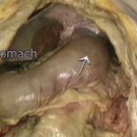 Aacland’s Anatomy Abdomen Video Lecture