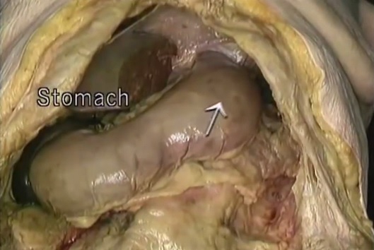 Acland’s Anatomy: The Abdomen