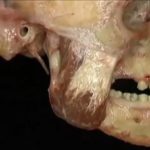 Aacland’s Anatomy Head and Neck Part 1 & Part 2