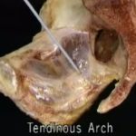 Aacland’s Anatomy The Pelvis & Perineum Video Lecture
