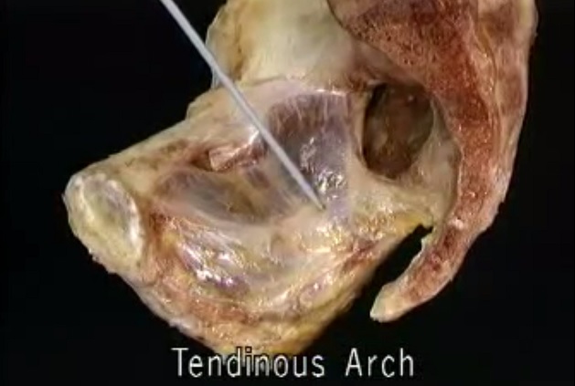 Acland’s Anatomy: The Pelvis & Perineum