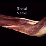 Aacland’s Anatomy Upper Limb Video Lecture