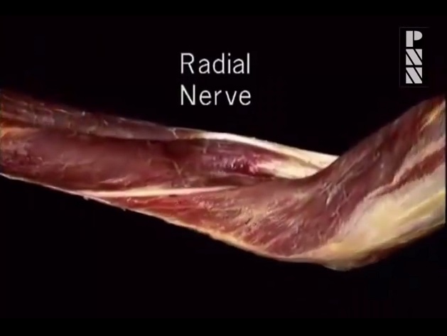 Acland’s Anatomy: Upper Limb