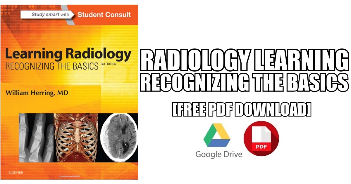 Learning Radiology Recognizing the Basics PDF