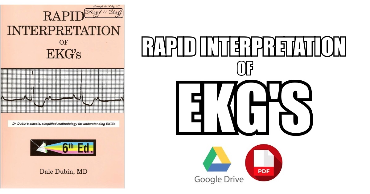 Rapid Interpretation of EKG´s: An Interactive Course Dubin，Dale