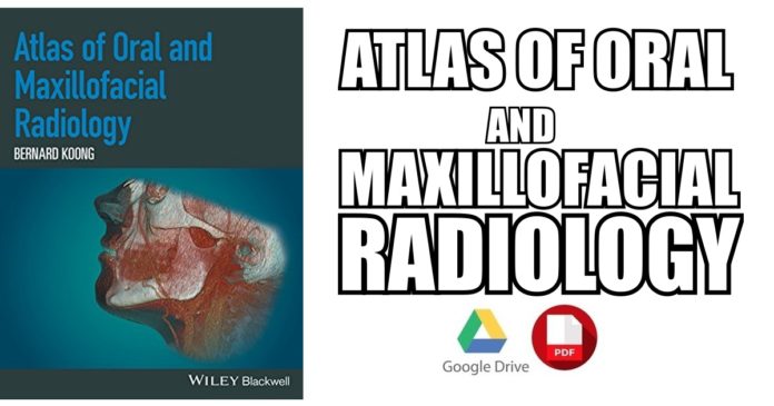 Atlas of Oral and Maxillofacial Radiology PDF