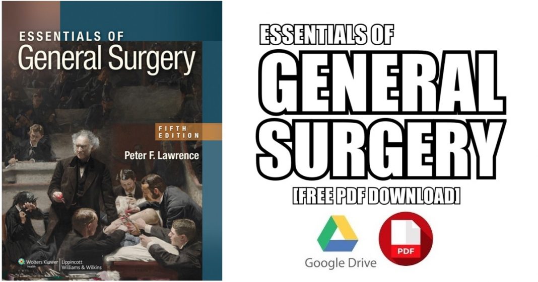 Essentials of General Surgery PDF Free Download [Direct Link]