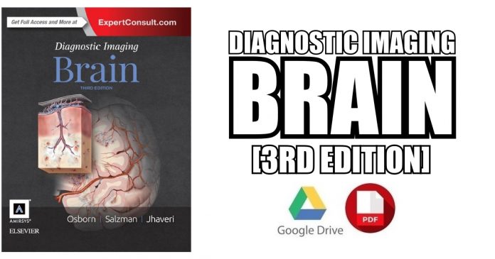 Diagnostic Imaging Brain 3rd Edition PDF