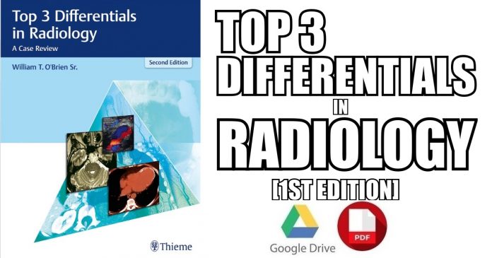 Top 3 Differentials in Radiology: A Case Review 1st Edition PDF