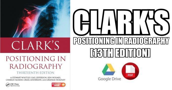 Clark's Positioning in Radiography 13th Edition PDF