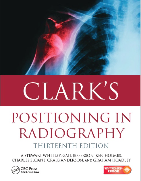 Clark's Positioning in Radiography 13th Edition PDF