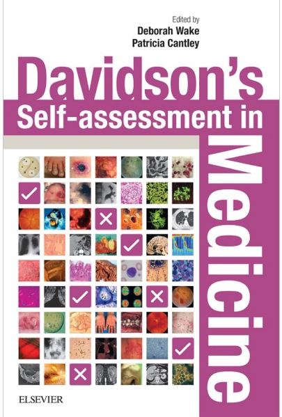 Davidson's Self-Assessment in Medicine 1st Edition PDF