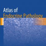 Atlas of Endocrine Pathology PDF