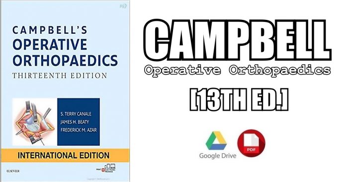 Campbell's Operative Orthopaedics 4-Volume Set 13th Edition PDF