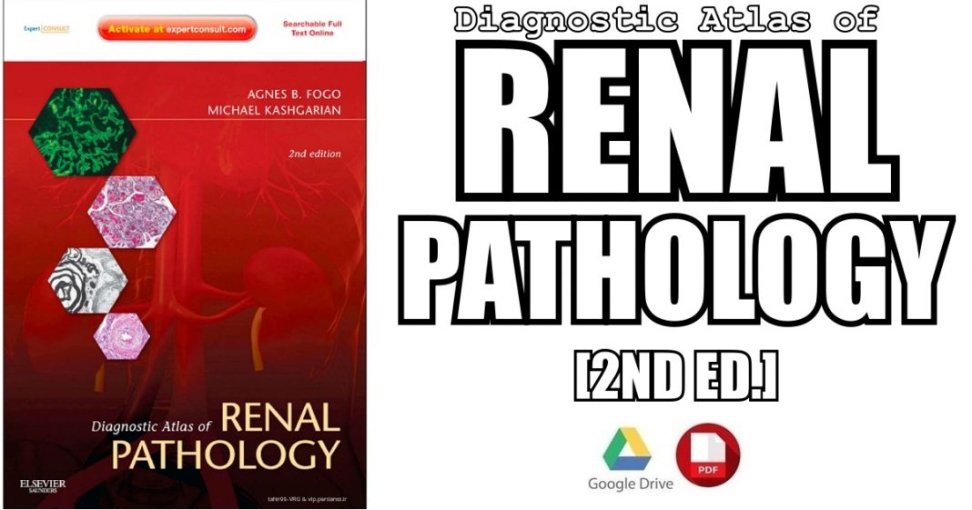 Diagnostic Atlas of Renal Pathology 2nd Edition PDF Free Download ...