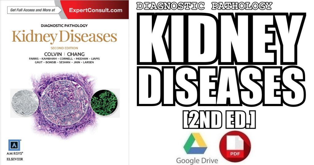 National Kidney Foundation Primer on Kidney Diseases 7th Edition PDF