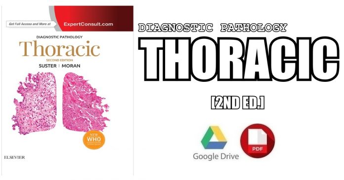 Diagnostic Pathology Thoracic 2nd Edition PDF