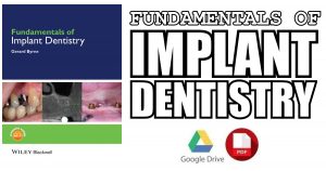 Fundamentals of Implant Dentistry 1st Edition PDF