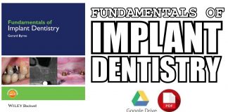 Fundamentals of Implant Dentistry 1st Edition PDF