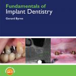 Fundamentals of Implant Dentistry Prosthodontic Principles