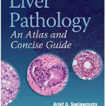 Liver Pathology: An Atlas and Concise Guide PDF