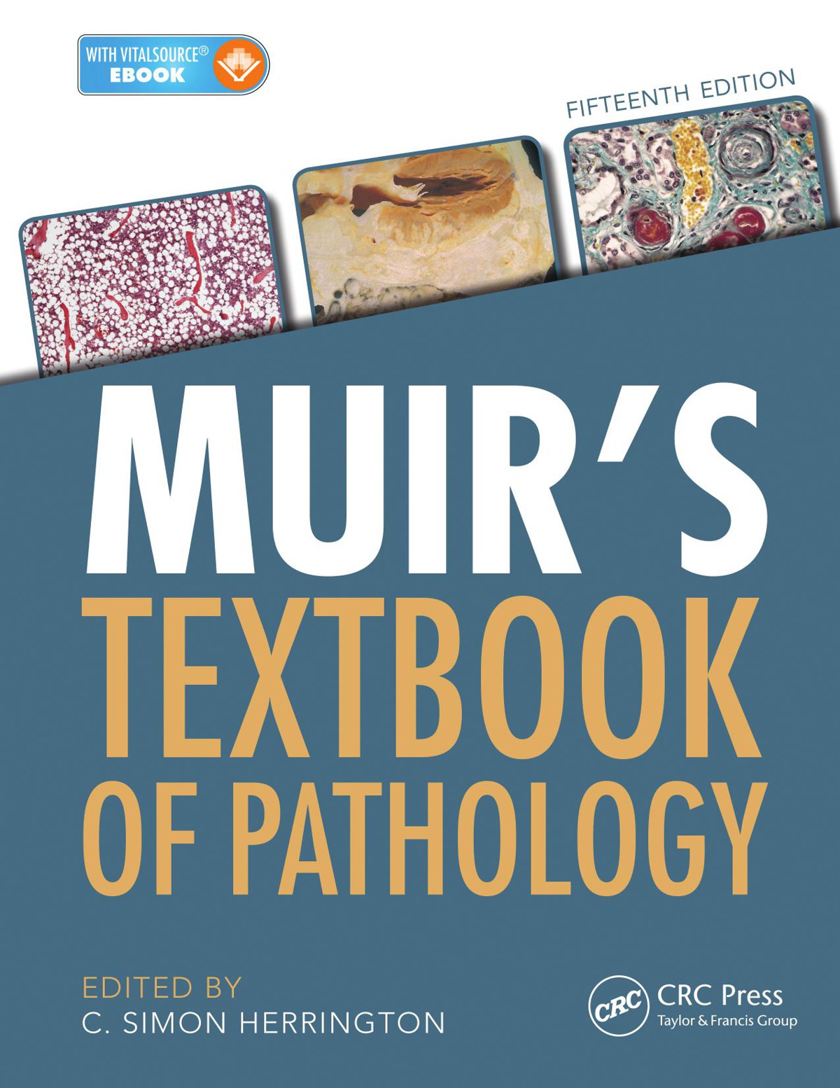 Muir's Textbook of Pathology 15th Edition PDF