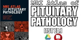 MRI Atlas of Pituitary Pathology 1st Edition PDF