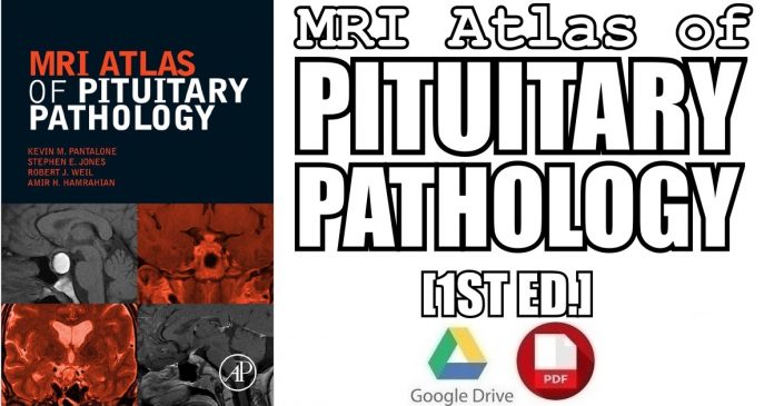 MRI Atlas of Pituitary Pathology 1st Edition PDF