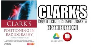 Clark's Positioning in Radiography 13th Edition PDF Free Download