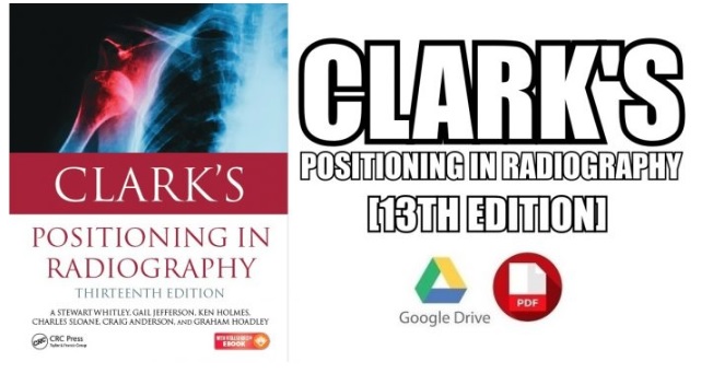 An Introduction to Resting State fMRI Functional Connectivity PDF Free ...