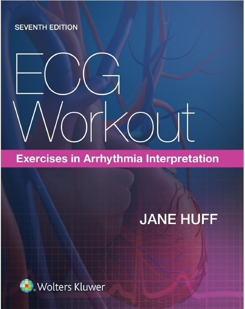 ECG Workout: Exercises in Arrhythmia Interpretation 7th Edition PDF
