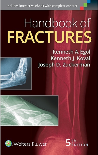 Handbook of Fractures 5th Edition PDF