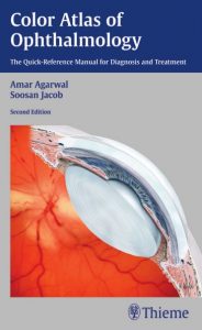 Color Atlas of Ophthalmology PDF