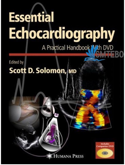 Essential Echocardiography by Scott D. Solomon PDF