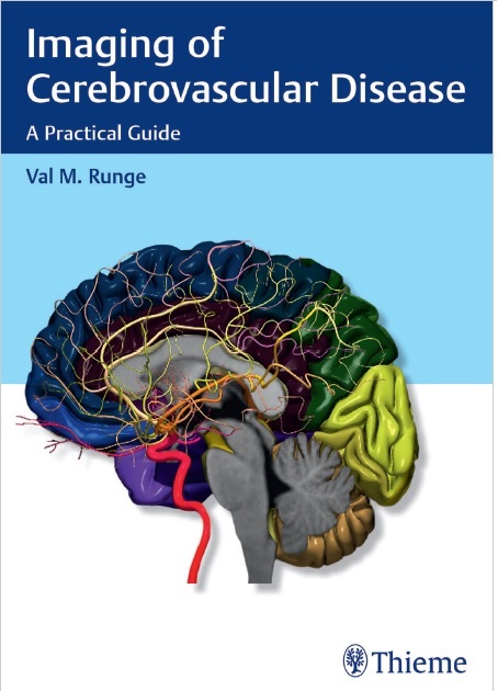 Imaging of Cerebrovascular Disease: A Practical Guide PDF