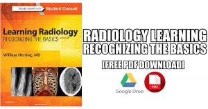 Learning Radiology Recognizing the Basics PDF Free Download
