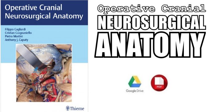 Operative Cranial Neurosurgical Anatomy 1st Edition PDF