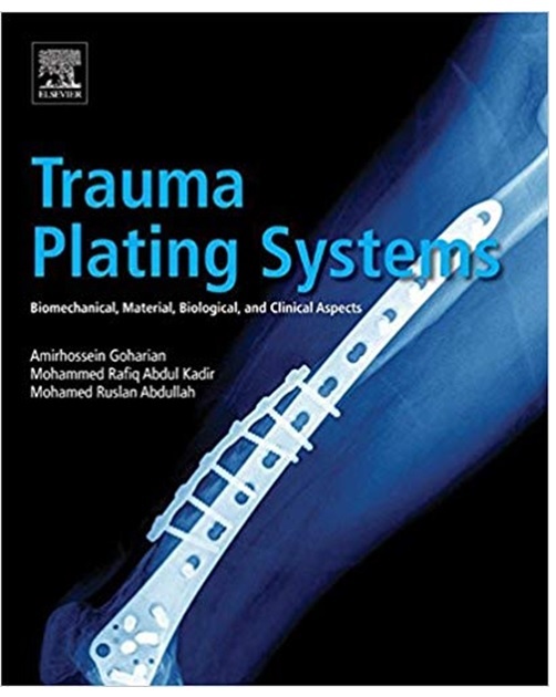 Trauma Plating Systems 1st Edition PDF