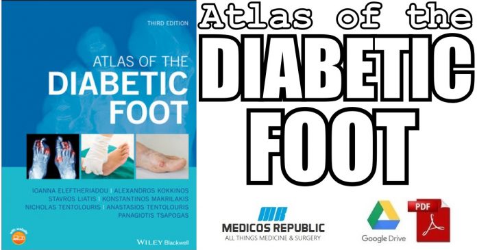 Atlas of the Diabetic Foot 3rd Edition PDF