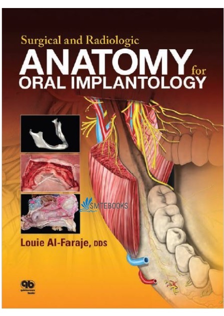 Surgical and Radiologic Anatomy for Oral Implantology 1st Edition PDF