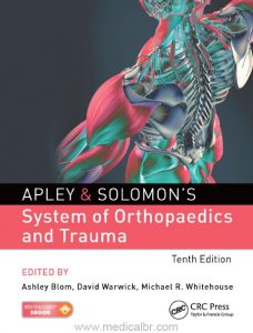 Apley & Solomon's System of Orthopaedics and Trauma 10th Edition PDF