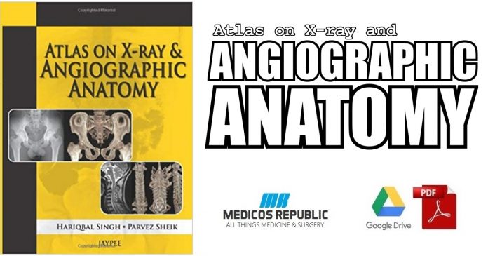 Atlas on X-ray and Angiographic Anatomy 1st Edition PDF