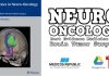 Controversies in Neuro-Oncology PDF