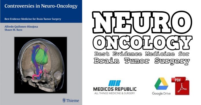 Controversies in Neuro-Oncology PDF