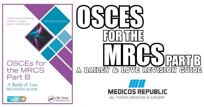OSCEs for the MRCS Part B: A Bailey & Love Revision Guide PDF
