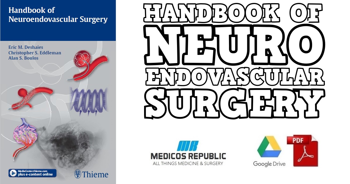 Handbook of Neuroendovascular Surgery 1st Edition PDF