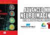 Advanced MR Neuroimaging from Theory to Clinical Practice PDF