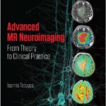 Advanced MR Neuroimaging from Theory to Clinical Practice PDF